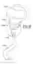 Fig. 10 - Safety tether