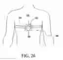 Fig. 23 - Support system for electronic device