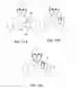 Fig. 27 - Support system for electronic device