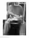 Fig. 05 - Device for facilitating self-dressing
