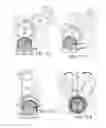 Fig. 19 - Device for facilitating self-dressing