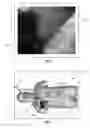 Fig. 05 - Method and system for assisting an operator in endoscopic navigation