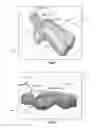 Fig. 06 - Method and system for assisting an operator in endoscopic navigation