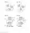 Fig. 04 - Method for assisting visual exploration for an individual suffering from a retinal condition resulting in a scotoma