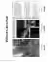 Fig. 68 - VERGENCE WEIGHTING SYSTEMS AND METHODS FOR TREATMENT OF PRESBYOPIA AND OTHER VISION CONDITIONS