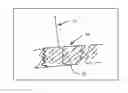 Fig. 01 - Effective acuity and refraction targets