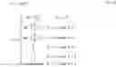 Fig. 02 - METHOD FOR DETERMINING DIASTASIS TIMING USING AN MRI SEPTAL SCOUT