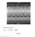 Fig. 04 - METHOD FOR DETERMINING DIASTASIS TIMING USING AN MRI SEPTAL SCOUT