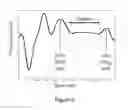Fig. 06 - METHOD FOR DETERMINING DIASTASIS TIMING USING AN MRI SEPTAL SCOUT
