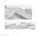 Fig. 11 - Method of characterizing wounds with Raman spectroscopy