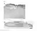 Fig. 12 - Method of characterizing wounds with Raman spectroscopy