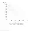 Fig. 17 - Method of characterizing wounds with Raman spectroscopy