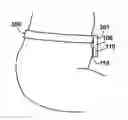 Fig. 01 - Wearable hip joint-action detectors