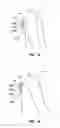 Fig. 12 - Wearable hip joint-action detectors