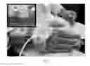 Fig. 02 - Diagnosing and treating movement disorders
