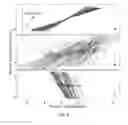 Fig. 05 - Diagnosing and treating movement disorders
