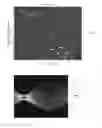 Fig. 05 - Sparse tracking in acoustic radiation force impulse imaging