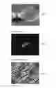 Fig. 06 - Sparse tracking in acoustic radiation force impulse imaging