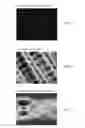Fig. 07 - Sparse tracking in acoustic radiation force impulse imaging
