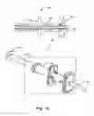 Fig. 03 - Fluid delivery device