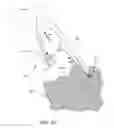 Fig. 14 - Exchangeable core biopsy needle