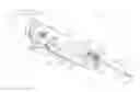 Fig. 01 - Biopsy device tissue sample holder with bulk chamber and pathology chamber