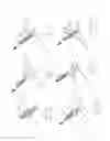 Fig. 15 - PNEUMOPERITONEUM DEVICE