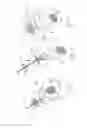 Fig. 26 - PNEUMOPERITONEUM DEVICE