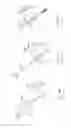 Fig. 30 - PNEUMOPERITONEUM DEVICE