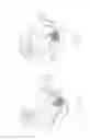 Fig. 34 - PNEUMOPERITONEUM DEVICE