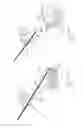 Fig. 46 - PNEUMOPERITONEUM DEVICE
