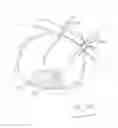 Fig. 61 - PNEUMOPERITONEUM DEVICE