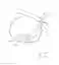 Fig. 62 - PNEUMOPERITONEUM DEVICE