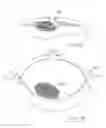 Fig. 78 - PNEUMOPERITONEUM DEVICE