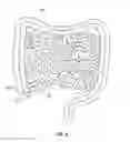 Fig. 05 - Organ retractor