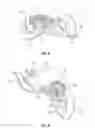 Fig. 06 - Organ retractor