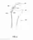 Fig. 03 - SUTURE-RETAINING DEVICE AND ANCHOR