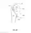 Fig. 11 - SUTURE-RETAINING DEVICE AND ANCHOR