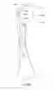 Fig. 14 - SUTURE-RETAINING DEVICE AND ANCHOR