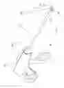Fig. 15 - Suture cutter