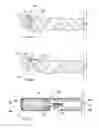 Fig. 22 - Suture cutter