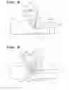 Fig. 05 - Surgical port closure device