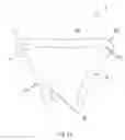 Fig. 16 - Staples for generating and applying compression within a body