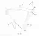 Fig. 25 - Staples for generating and applying compression within a body
