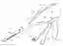 Fig. 01 - Manually driven surgical cutting and fastening instrument