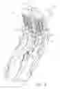 Fig. 08 - Manually driven surgical cutting and fastening instrument
