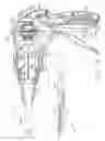 Fig. 12 - Manually driven surgical cutting and fastening instrument