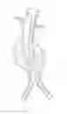 Fig. 02 - Endovascular aneurysm repair system