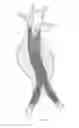 Fig. 05 - Endovascular aneurysm repair system