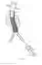 Fig. 11 - Endovascular aneurysm repair system